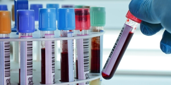 مطلوب كيميائى للعمل بالعيادات الطبية