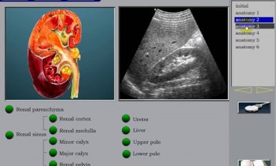 Kidney Ultrasound سونار الكلى