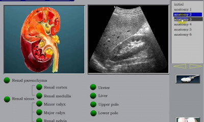 Kidney Ultrasound سونار الكلى