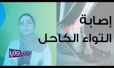 علاج طبيعي