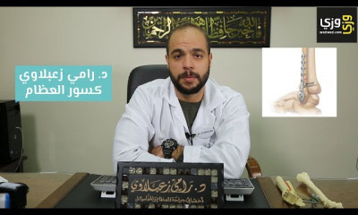 عظام ومفاصل