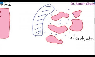 علم أمراض العظام bone pathology