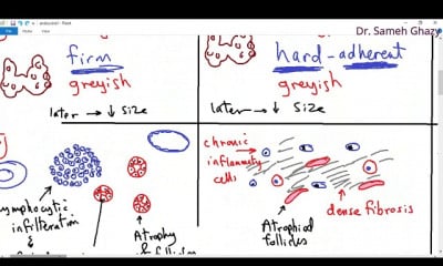 علم أمراض الغدد الصماء endocrine pathology