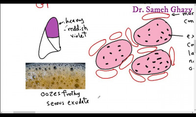 أمراض الجهاز التنفسي respiratory system pathology