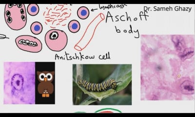 أمراض القلب والأوعية الدموية 2020 cardiovascular pathology