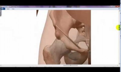 التشريح التطبيقي والسطحى lower limb applied and surface anatomy