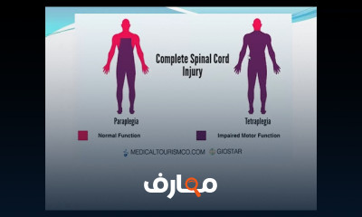 العلاج الطبيعي