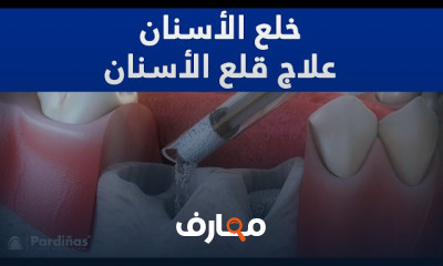 طب الأسنان