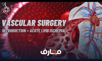 Vascular Surgery | جراحة الأوعية الدموية