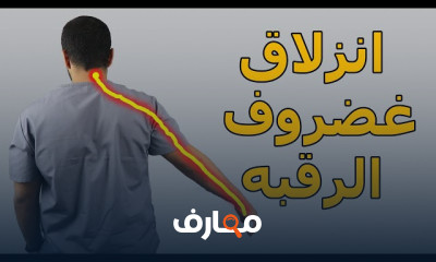 علاج انزلاق الغضروف