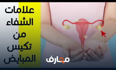تكيس المبيض اكتشفي الأسرار لتجاوز اسباب تكيسات المبايض