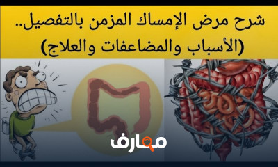 أطعمة للتخلص من الإمساك والملينات الطبيعية