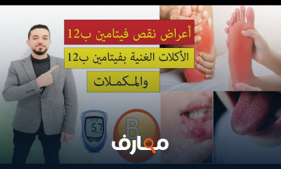 الأكلات الغنية بفيتامين ب 12 والمكملات