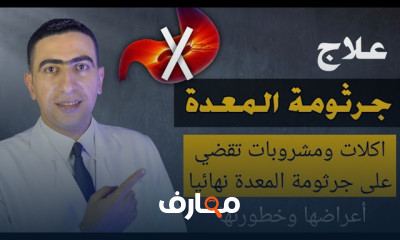 اعراض سرطان القولون فى الجسم
