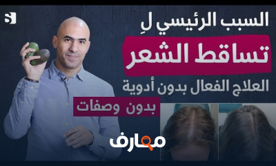 علاج تساقط الشعر النهائي