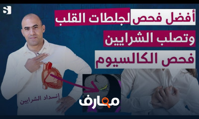 فحص تصلب الشرايين التاجية و الجلطات القلبية