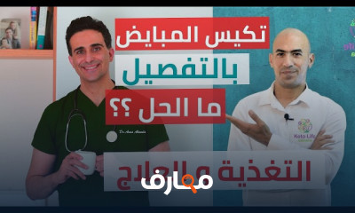 علاج تكيس المبايض عند المرأة