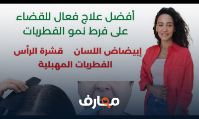 علاج جرثومة المعدة بدون مضاد حيوي