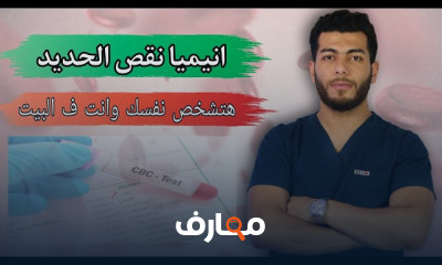 علاج فقر الدم وانيميا نقص الحديد