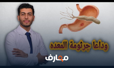 أعراض جرثومة المعدة وطريقة علاجها