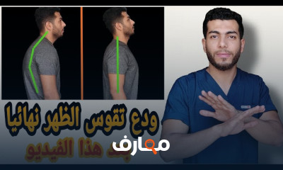 علاج تقوس الظهر وانحناء الاكتاف