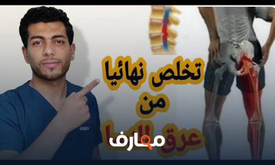 علاج عرق النسا والانزلاق الغضروفى بدون جراحه