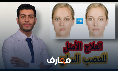 علاج العصب السابع وشلل الوجه النصفى