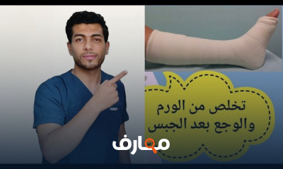 علاج تيبس مفصل الكوع بعد الجبس
