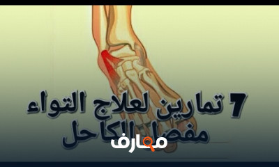 علاج التواء الكاحل بالتمارين