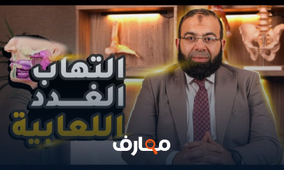 أعراض حصوات الغدد اللعابية وأضرارها