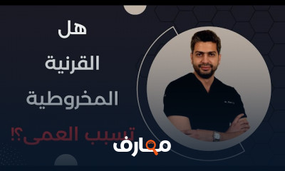 طرق علاج القرنية المخروطية بأحدث الوسائل