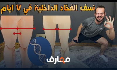 تمرين DEAD Bug لشد البطن بسرعة