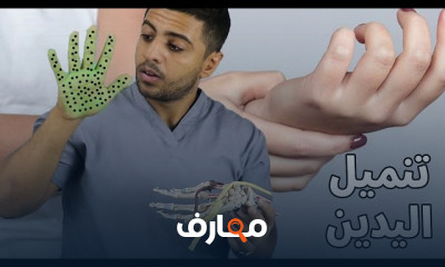 أسباب تنميل اليد والأصابع وعلاجها