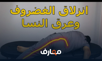 علاج التهابات الأعصاب في اليد والقدم والظهر