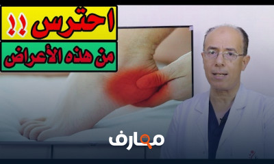 طرق علاج الشوكة العظمية وآلم الكعب بدون أدوية