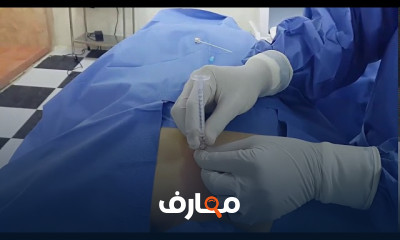 طرق علاج آلام الرقبة والذراعين وآلام خلف الرأس