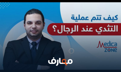 أسباب التثدي عند الرجال وطرق علاجها