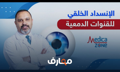 كيفية اكتشاف القرنية المخروطية في المراحل المبكرة