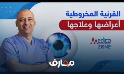 علاج القرنية المخروطية وأعراضها