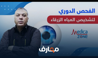 أسباب المياه الزرقاء في العين وعلاجها