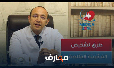طرق تشخيص المشيمة الملتصقة بالرحم