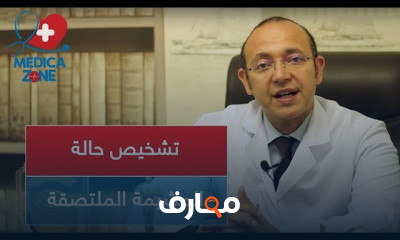 تشخيص حالة المشيمة الملتصقة بالرحم