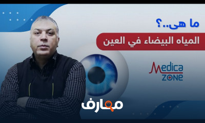 أنواع المياه البيضاء في العين