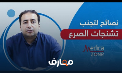 طرق التعامل مع مريض الصرع أثناء نوبة التشنج