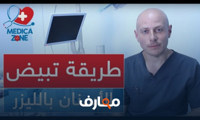 طريقة تبييض الأسنان في المنزل