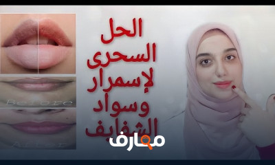 أفضل مرطبات شفايف علاجية