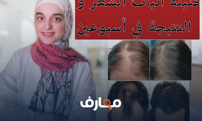 فوائد زيت الروزمارى لانبات الشعر وملئ الفراغات