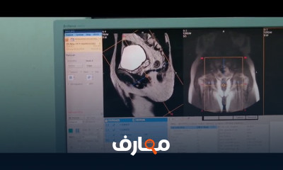 اشعة الرنين المغناطيسي