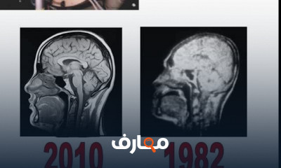 الرنين المغناطيسي MRI Basics