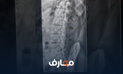 التشخيص الطبي الأشعة العادية